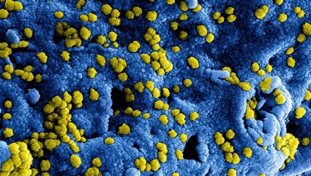 دراسة: السلالة الجديدة لفيروس كورونا أكثر فتكا وانتشارا
