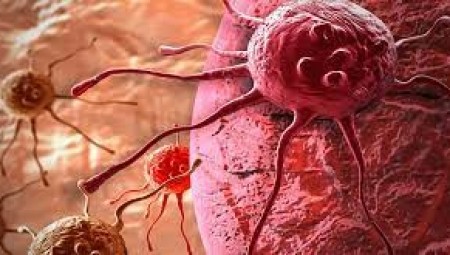 التوصل إلى تقنية جديدة توقف انتشار الأورام السرطانية