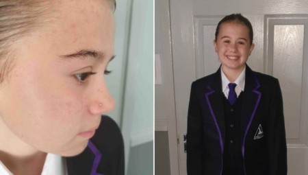 مدرسة بريطانية تعزل طالبة عمرها 11 عامًا لأنها ثقبت أنفها