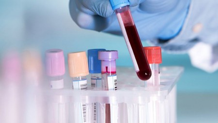 بريطانيا .. اطلاق أكبر تجربة اختبار دم في العالم لخمسين نوعا من السرطان