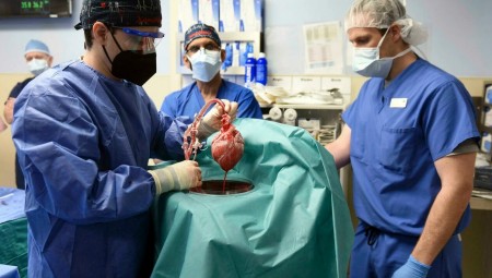 جراحون ينجحون في زرع قلب خنزير في جسم إنسان