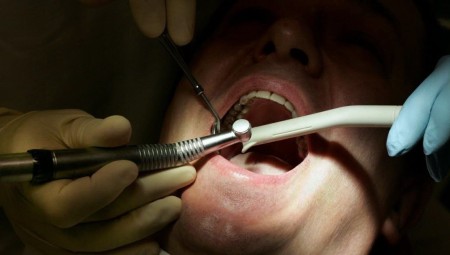 هل أصبح إيجاد طبيب أسنان بسعر معقول في بريطانيا مستحيلا؟