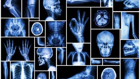 تجارب جديدة تثبت أن الذكاء الاصطناعي قد يساهم في تحسين أداء أقسام الأشعة في NHS