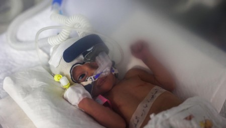 بريطانيا تُطلق خطة طبية لنقل 300 طفل من غزة ضمن عملية إنسانية عاجلة