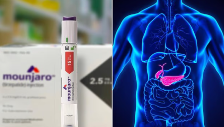 ارتفاع غير مسبوق في عمليات استئصال المرارة يثير تساؤلات حول حقن التخسيس