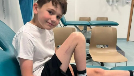 نجاح أول عملية لإطالة ساق طفل في المملكة المتحدة بتقنية حديثة